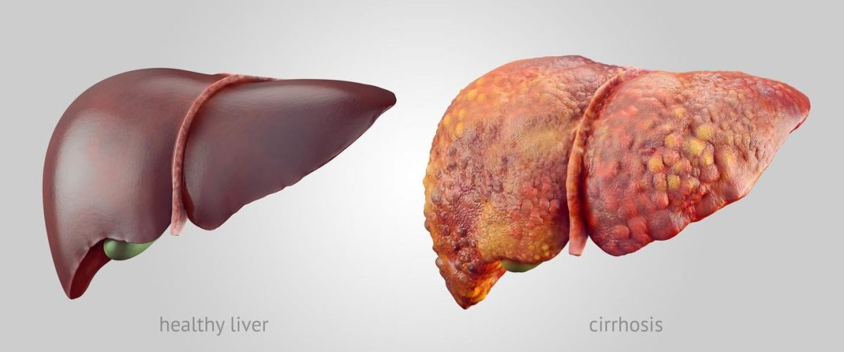 Descubre 10 formas efectivas de limpiar las arterias naturalmente 1 descubre 10 formas efectivas de limpiar las arterias naturalmente